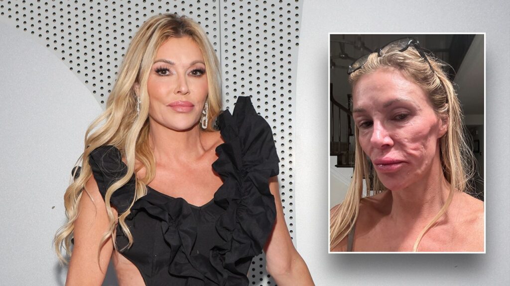 Brandi Glanville says celibacy is ‘not by choice’ amid ongoing health battle Brandi Glanville says celibacy is ‘not by choice’ amid ongoing health battle