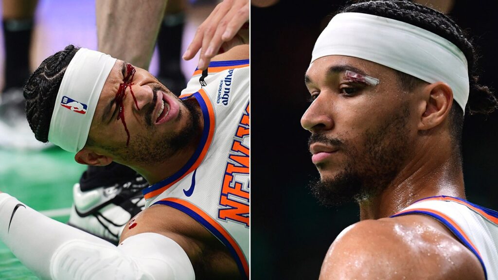 NBA playoffs: Knicks’ Josh Hart briefly leaves game with bloody eye