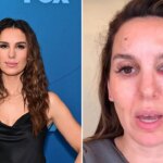 Christy Carlson Romano reveals shocking details about nearly losing her eye
