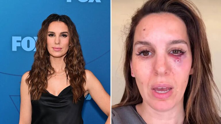 Christy Carlson Romano reveals shocking details about nearly losing her eye