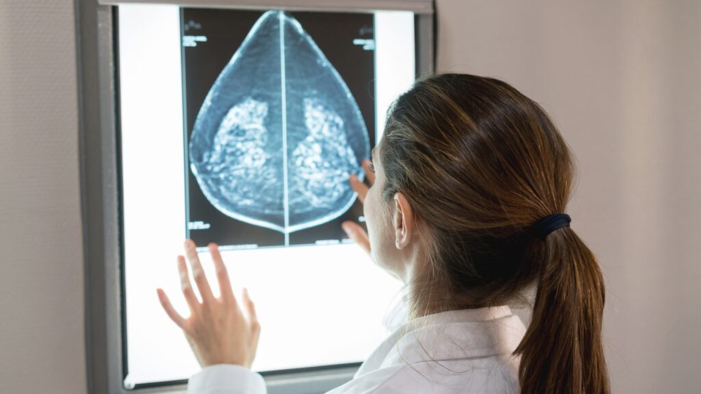 Breast cancer AI tool gets FDA approval, uses mammograms to predict risk Breast cancer AI tool gets FDA approval, uses mammograms to predict risk