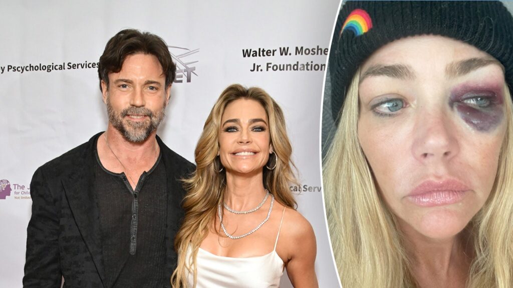 Aaron Phypers denies Denise Richards’ domestic violence accusations