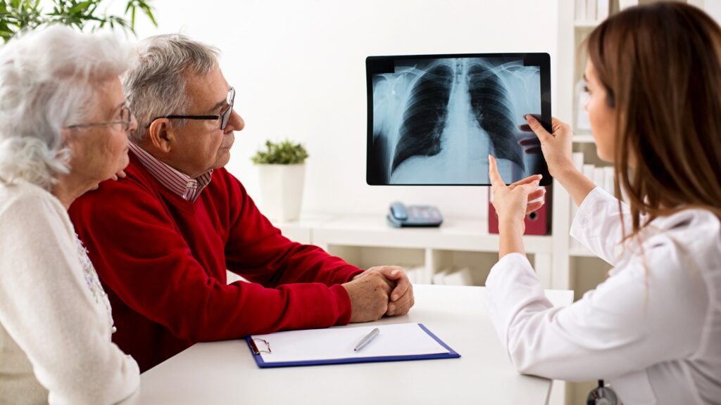 Lung cancer risk exists beyond smoking, as experts note rising cases
