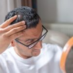 New hair loss treatment shows significant improvement over placebo